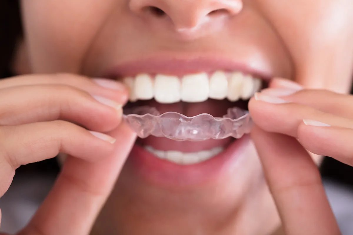 Diseño Sonrisa