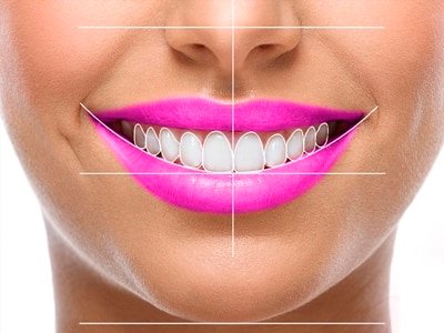 Diseño Sonrisa