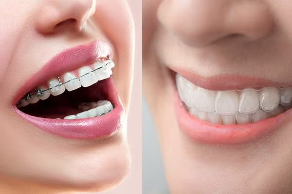Diseño Sonrisa