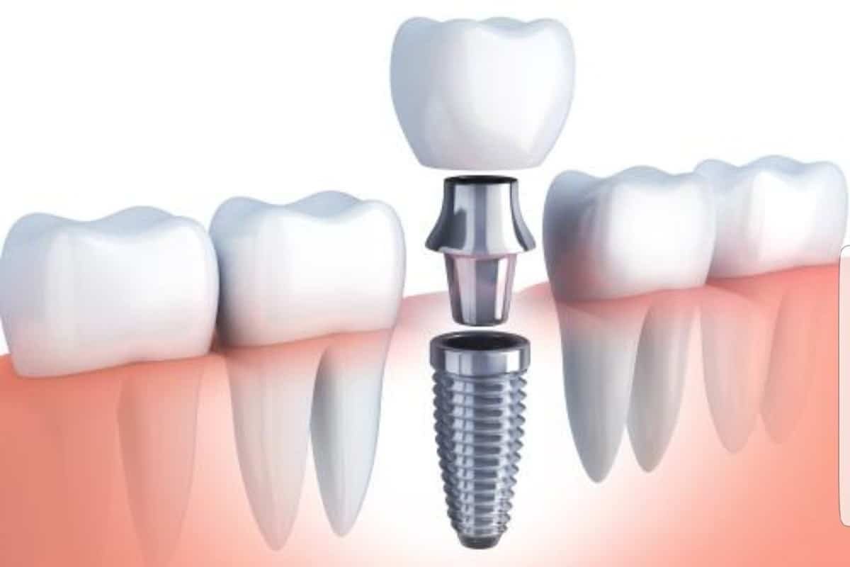 Diseño Sonrisa
